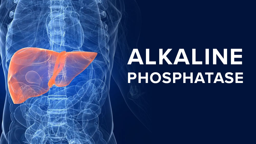 What Foods To Avoid If Alkaline Phosphatase Is High?